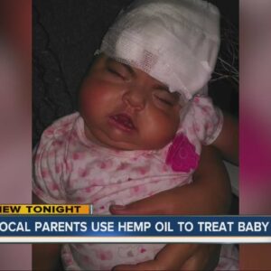 Local parents use hemp oil to treat baby